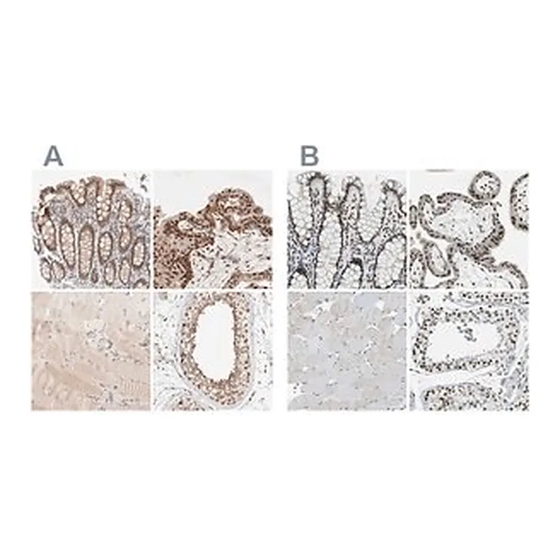 Merck Anti-GATAD2A antibody produced in rabbit