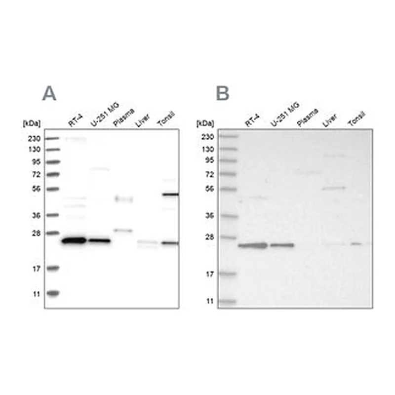 Merck Anti-VPS28 antibody produced in rabbit