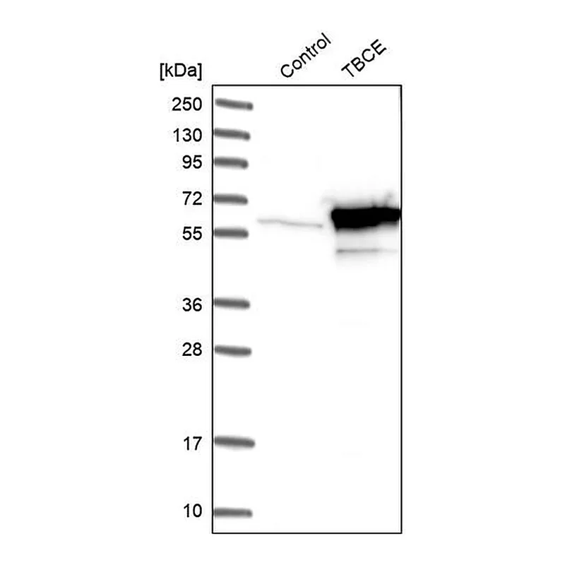 Merck Anti-TBCE antibody produced in rabbit