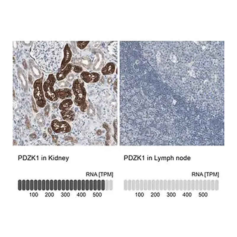 Merck Anti-PDZK1 antibody produced in rabbit