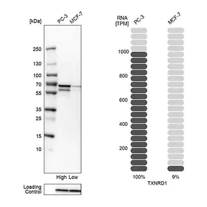 Merck Anti-TXNRD1 antibody produced in rabbit
