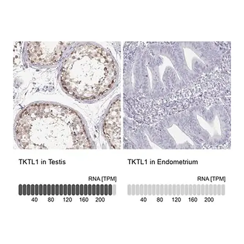 Merck Anti-TKTL1 antibody produced in rabbit