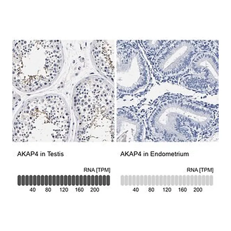 Merck Anti-AKAP4 antibody produced in rabbit