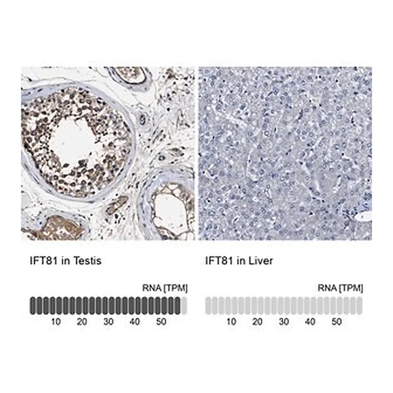 Merck Anti-IFT81 antibody produced in rabbit