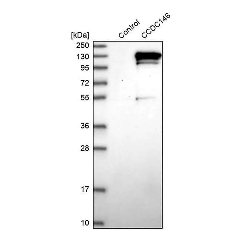 Merck Anti-CCDC146 antibody produced in rabbit
