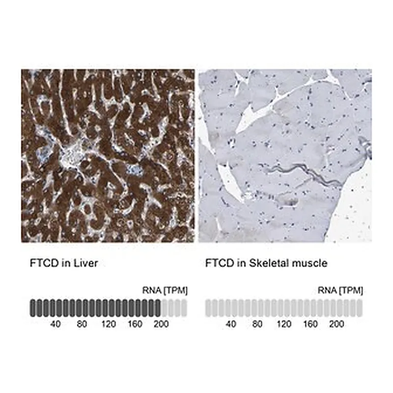 Merck Anti-FTCD antibody produced in rabbit