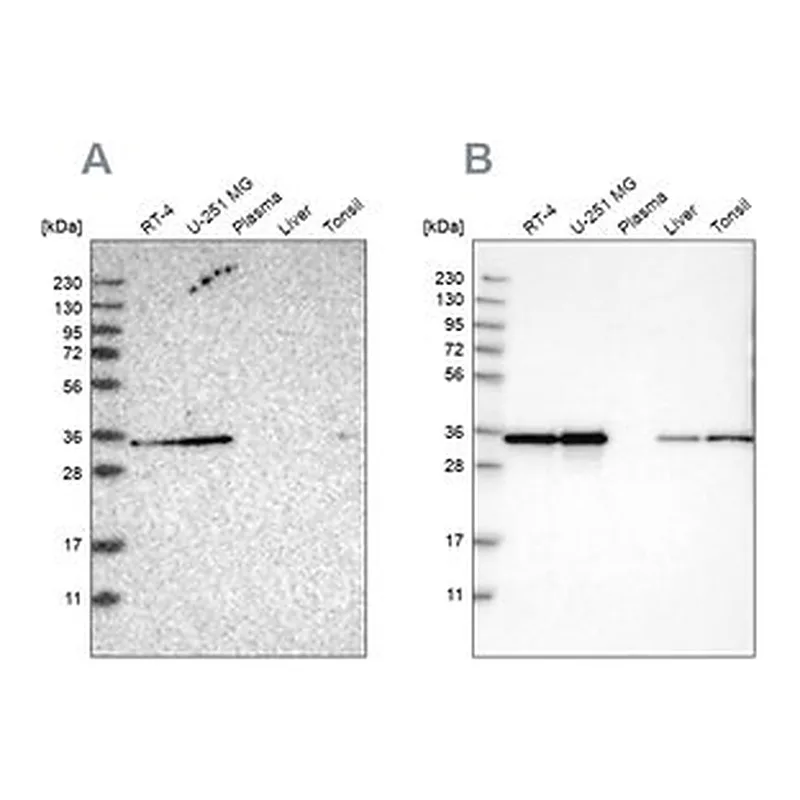 Merck Anti-PPA1 antibody produced in rabbit