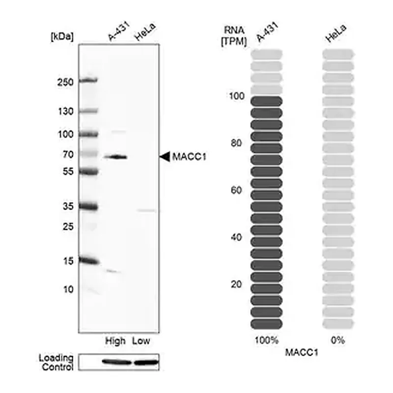 Merck Anti-MACC1 antibody produced in rabbit