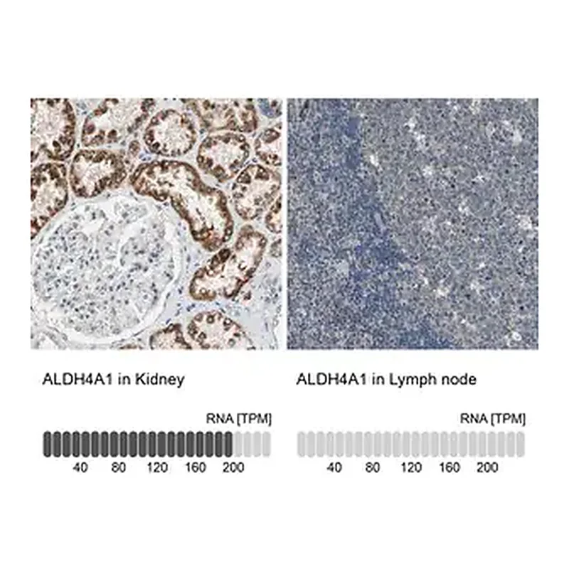 Merck Anti-ALDH4A1 antibody produced in rabbit