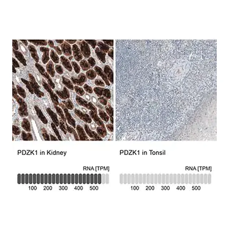 Merck Anti-PDZK1 antibody produced in rabbit