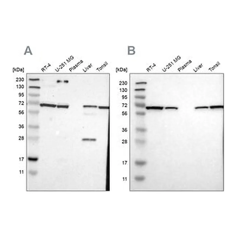 Merck Anti-LTA4H antibody produced in rabbit
