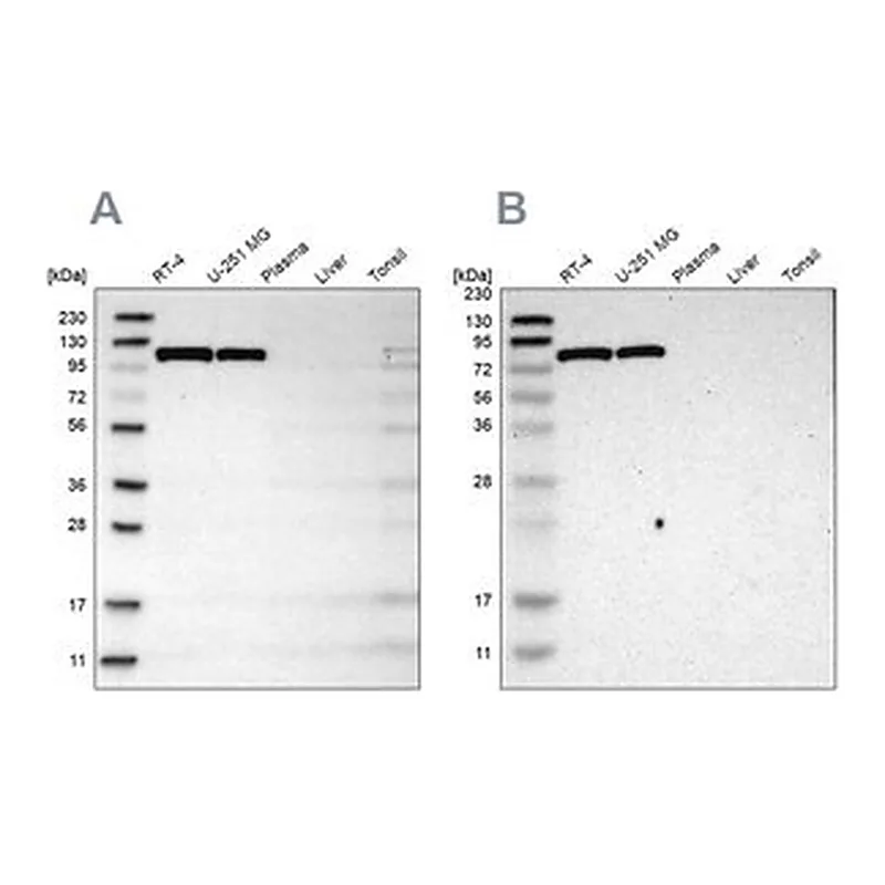 Merck Anti-HK1 antibody produced in rabbit