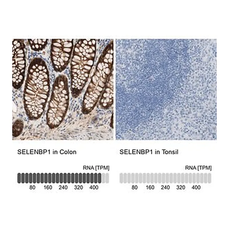 Merck Anti-SELENBP1 antibody produced in rabbit