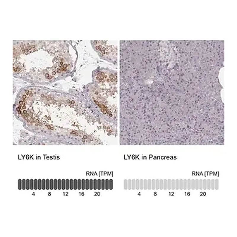 Merck Anti-LY6K antibody produced in rabbit