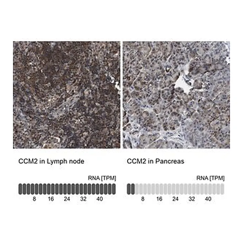 Merck Anti-CCM2 antibody produced in rabbit