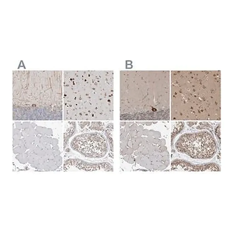Merck Anti-ATXN2 antibody produced in rabbit