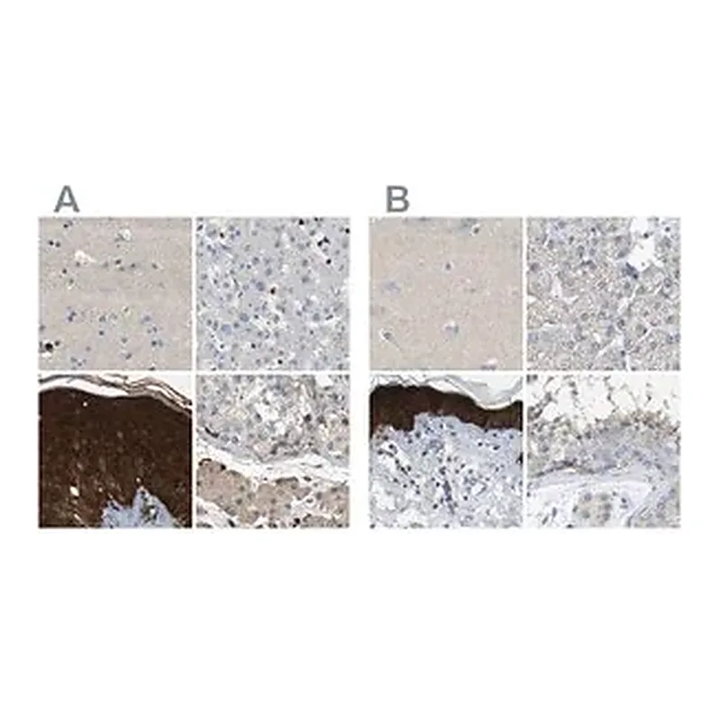 Merck Anti-SERPINB5 antibody produced in rabbit