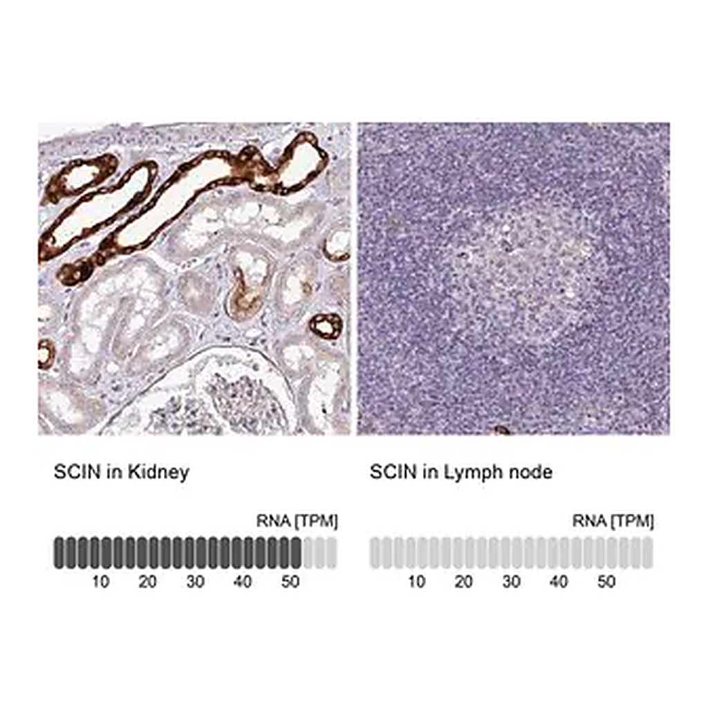 Merck Anti-SCIN antibody produced in rabbit