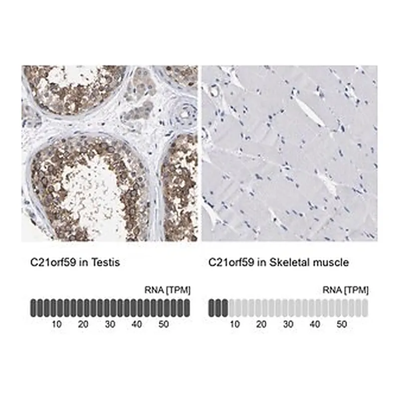 Merck Anti-C21orf59 antibody produced in rabbit