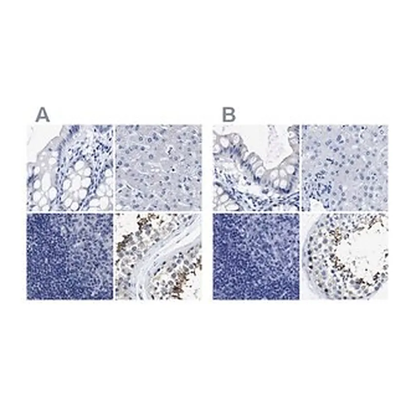 Merck Anti-HOOK1 antibody produced in rabbit