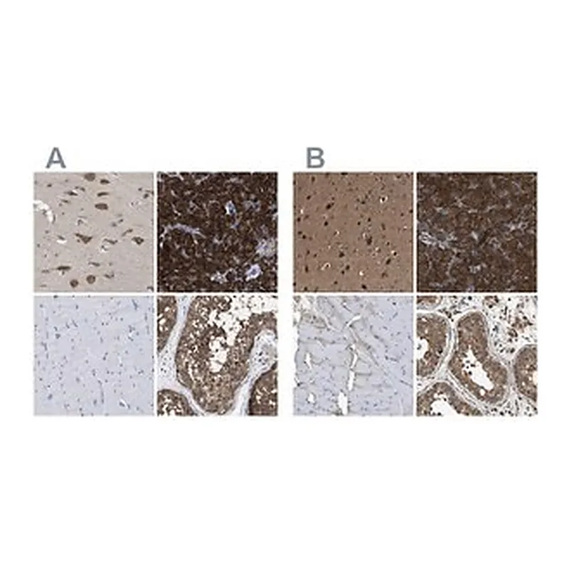 Merck Anti-YARS antibody produced in rabbit
