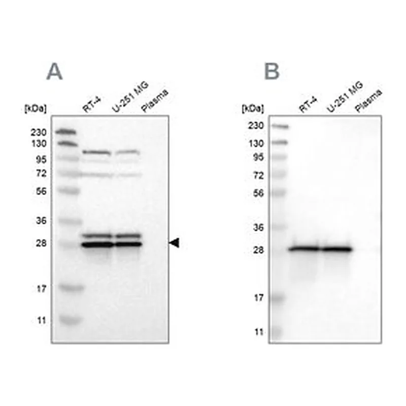 Merck Anti-ETFB antibody produced in rabbit