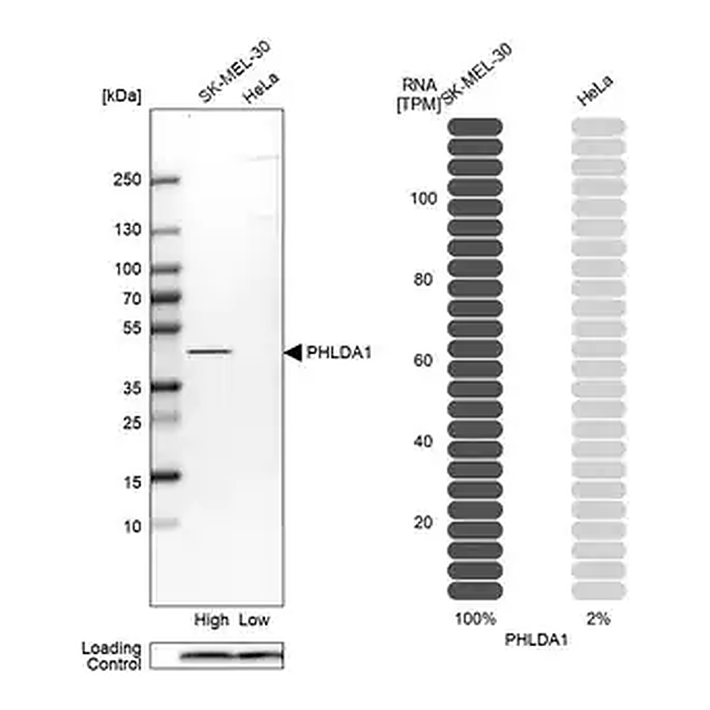 Merck Anti-PHLDA1 antibody produced in rabbit