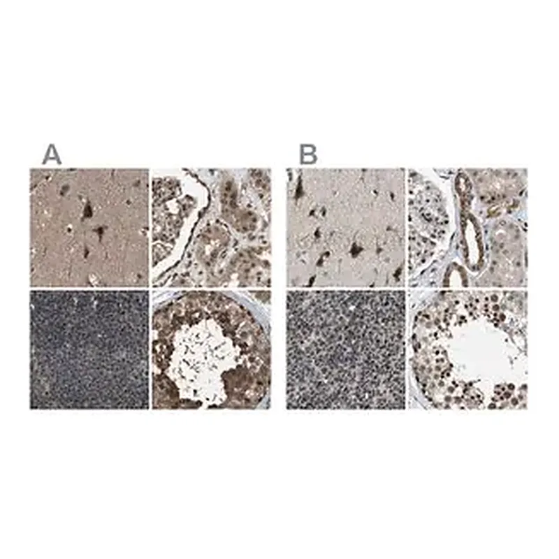 Merck Anti-SERTAD2 antibody produced in rabbit