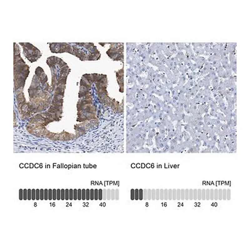 Merck Anti-CCDC6 antibody produced in rabbit