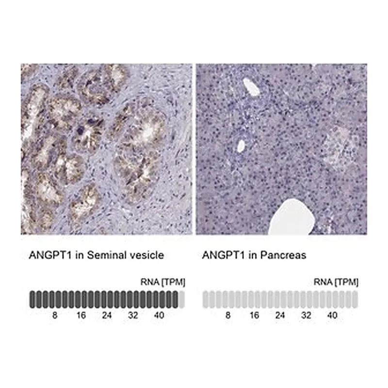 Merck Anti-ANGPT1 antibody produced in rabbit