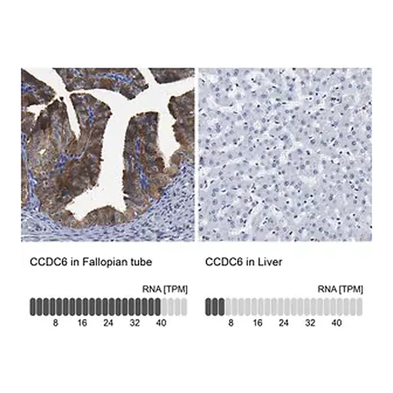 Merck Anti-CCDC6 antibody produced in rabbit