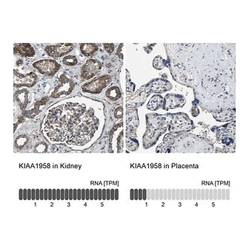 Merck Anti-KIAA1958 antibody produced in rabbit