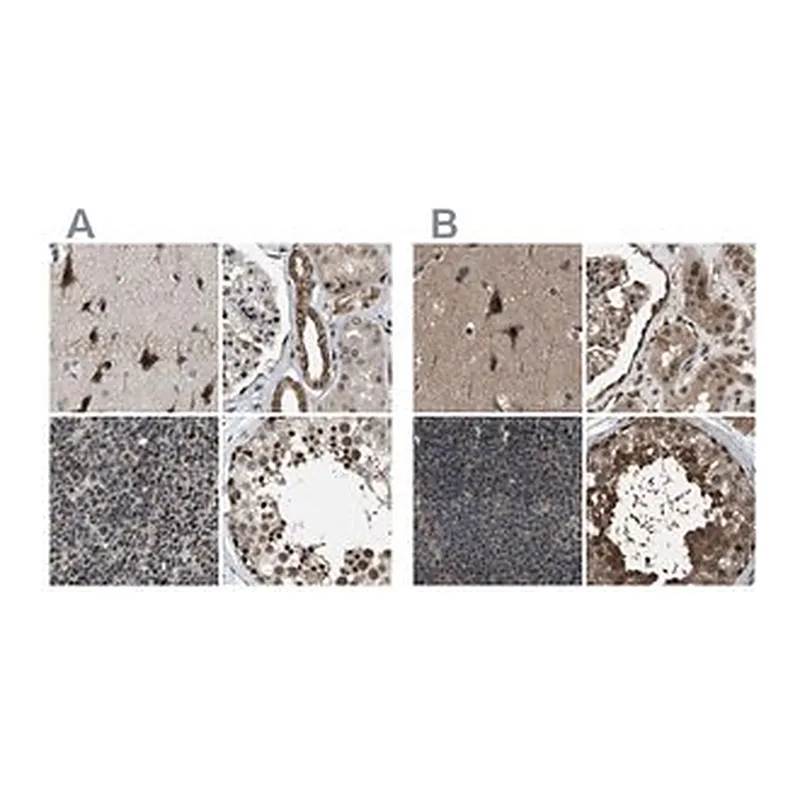 Merck Anti-SERTAD2 antibody produced in rabbit