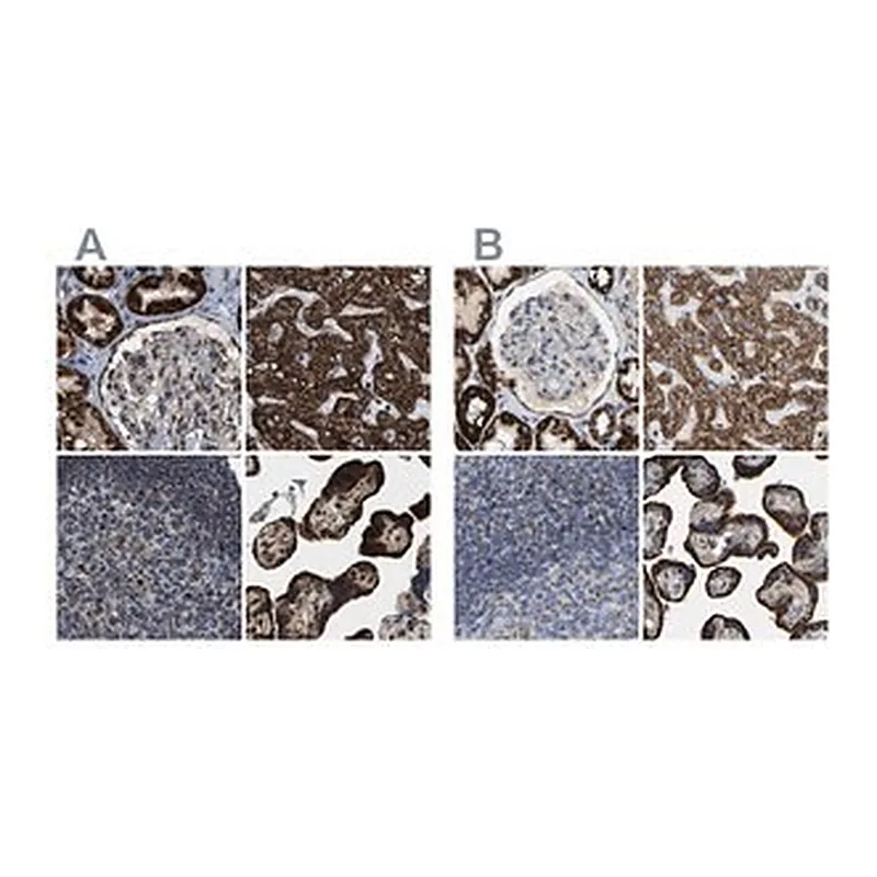 Merck Anti-HIBADH antibody produced in rabbit