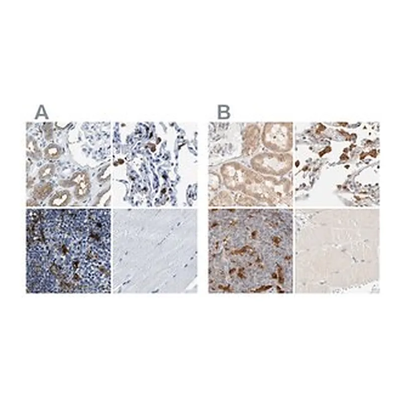 Merck Anti-CAPG antibody produced in rabbit