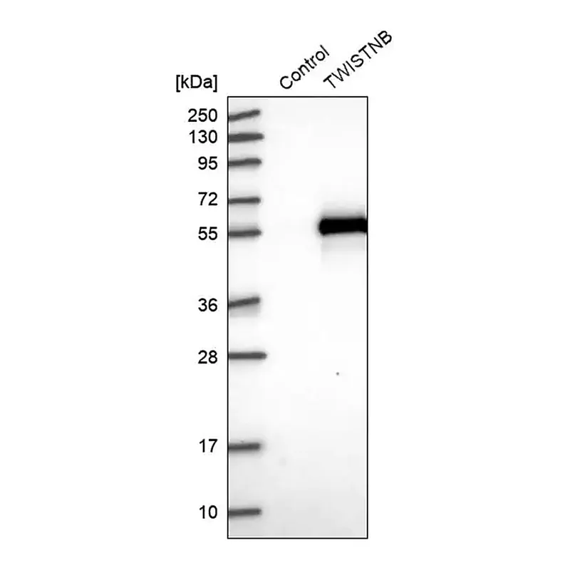 Merck Anti-TWISTNB antibody produced in rabbit
