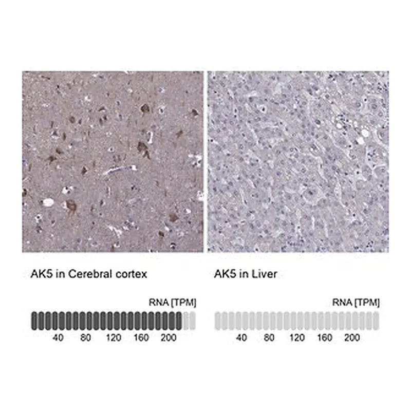 Merck Anti-AK5 antibody produced in rabbit