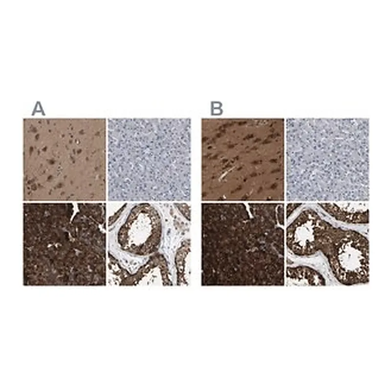 Merck Anti-GARS antibody produced in rabbit