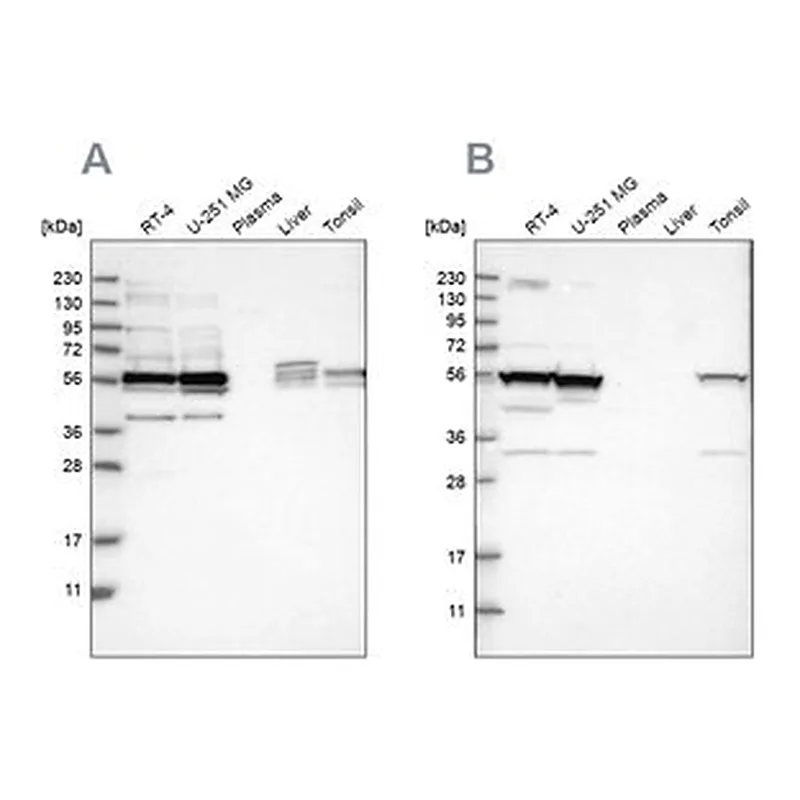Merck Anti-SMU1 antibody produced in rabbit