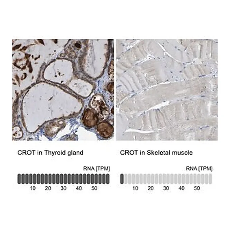 Merck Anti-CROT antibody produced in rabbit