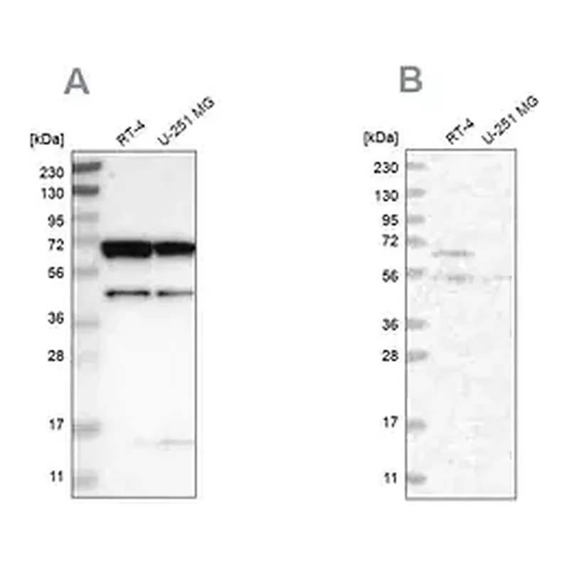 Merck Anti-CROT antibody produced in rabbit
