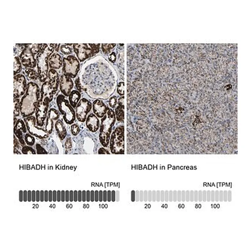Merck Anti-HIBADH antibody produced in rabbit