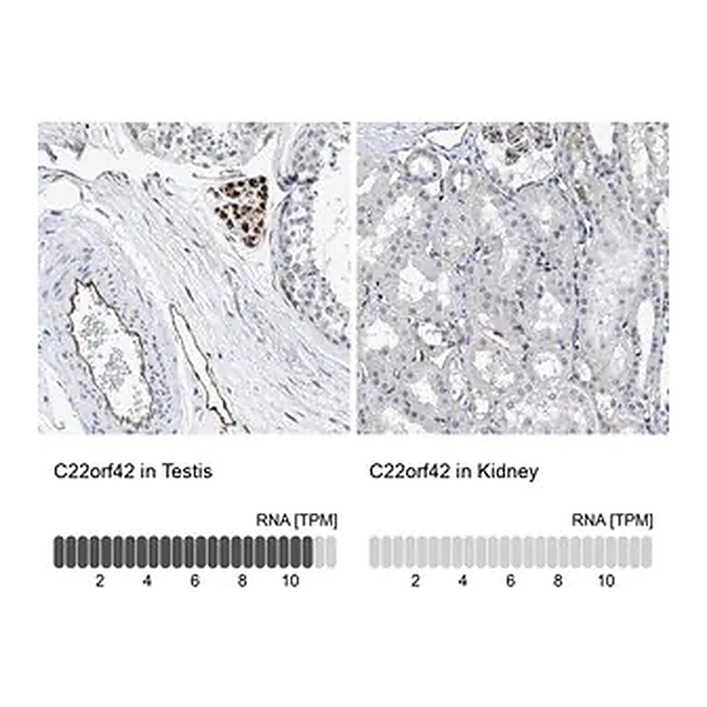 Merck Anti-C22orf42 antibody produced in rabbit