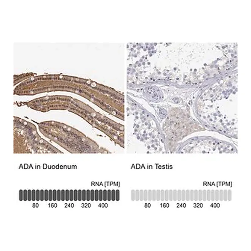Merck Anti-ADA antibody produced in rabbit