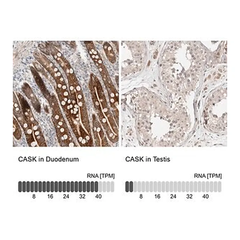 Merck Anti-CASK antibody produced in rabbit