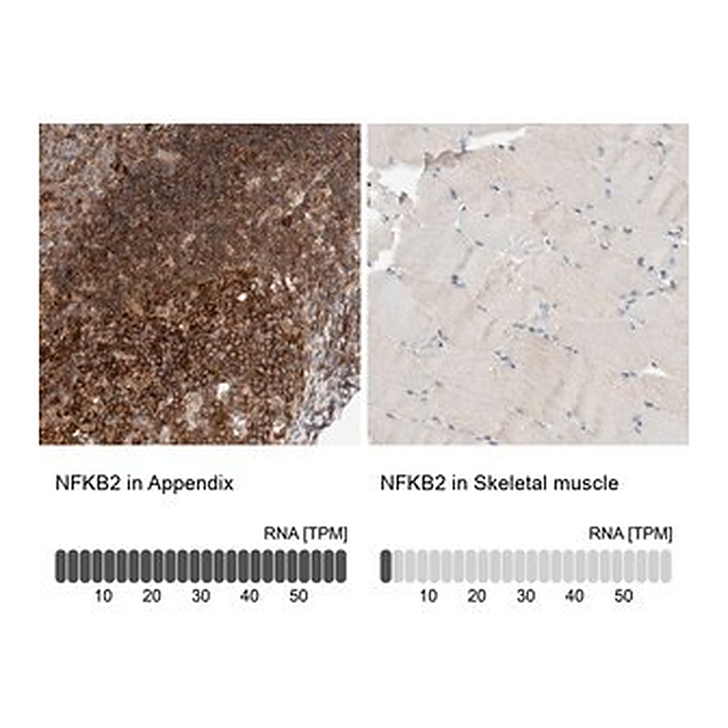 Merck Anti-NFKB2 antibody produced in rabbit