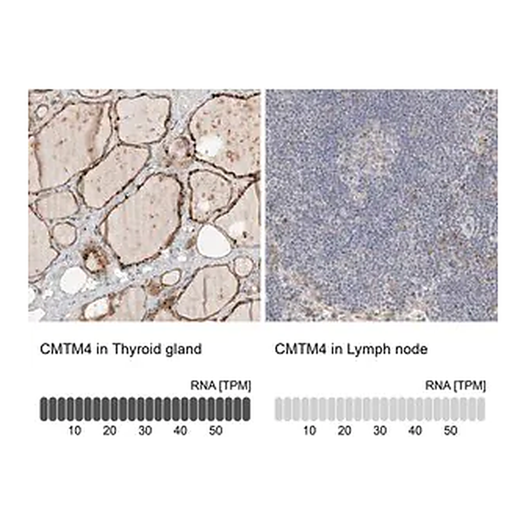 Merck Anti-CMTM4 antibody produced in rabbit