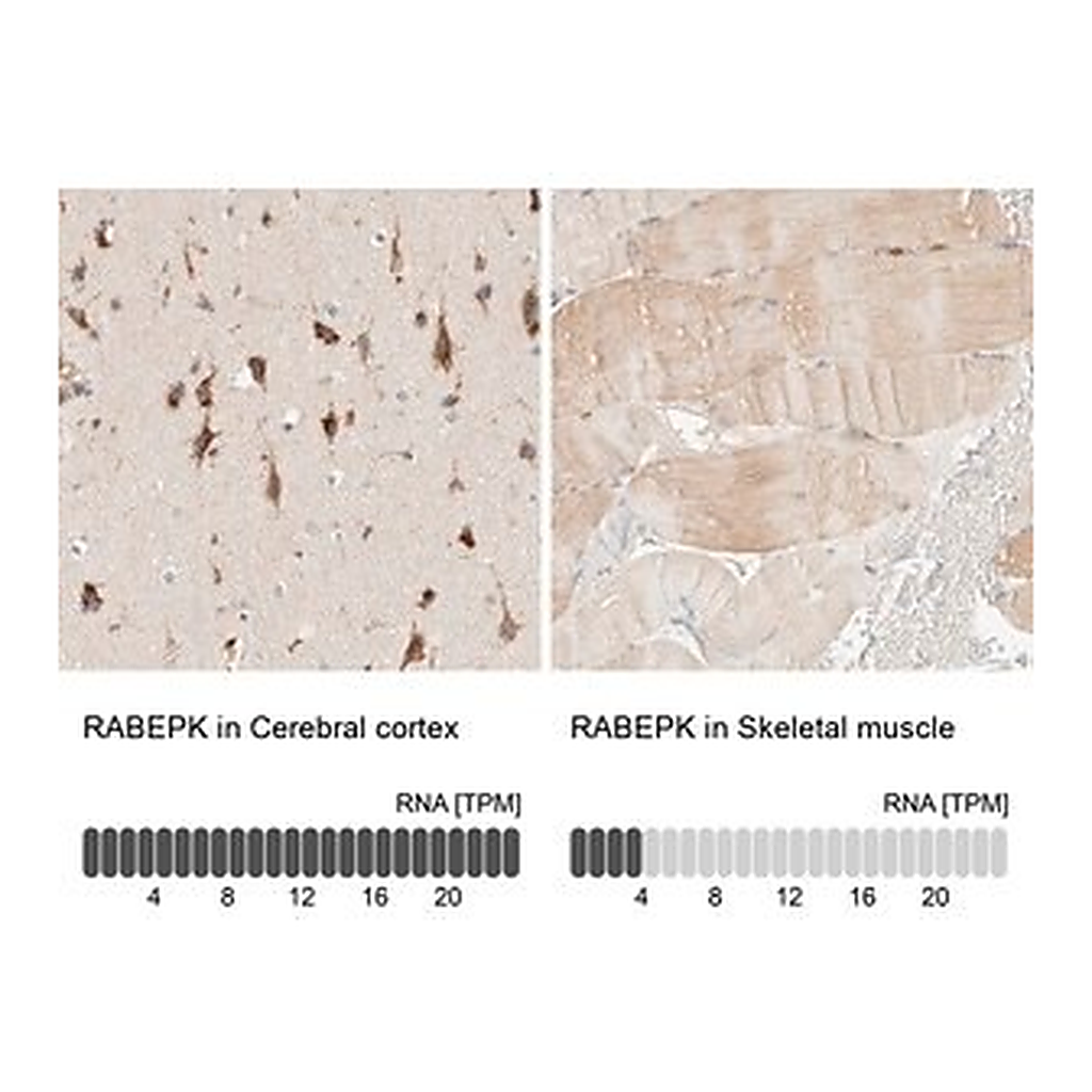 Merck Anti-RABEPK antibody produced in rabbit