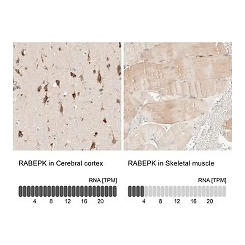 Merck Anti-RABEPK antibody produced in rabbit