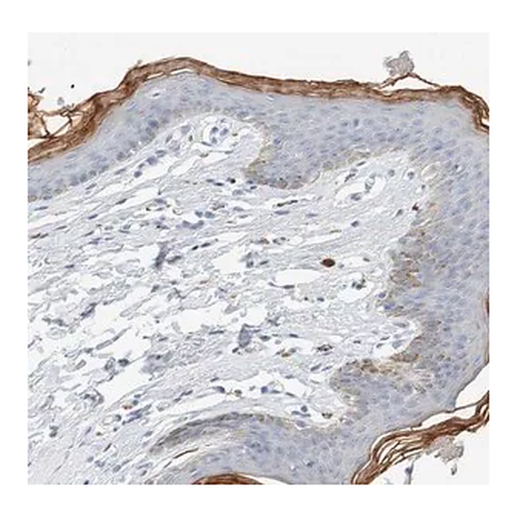 Merck Anti-ALOX12B antibody produced in rabbit